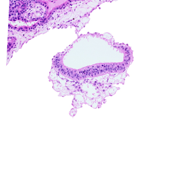 amnion, cephalic edge of umbilical vesicle cavity, epiblast, extra-embryonic endoderm, extra-embryonic mesoblast, head mesenchyme, hypoblast, junction of amnion and embryonic disc