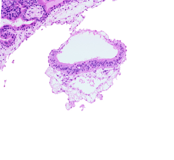 amnion, amniotic cavity, cephalic edge of umbilical vesicle cavity, epiblast, extra-embryonic mesoblast, hypoblast, junction of amnion and embryonic disc