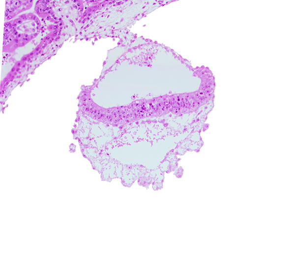 amniotic cavity, connecting stalk, epiblast, extra-embryonic endoderm, head mesenchyme, hypoblast, mesothelium, two-layered umbilical vesicle wall, umbilical vesicle cavity