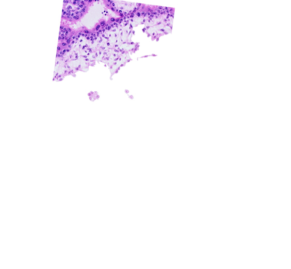 chorionic cavity (extra-embryonic coelom or exocoelom), extra-embryonic mesoblast, floating villus, intervillus space(s)