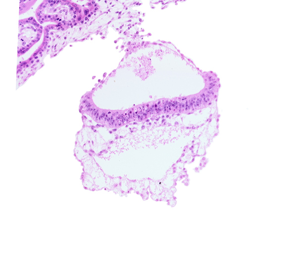 amniotic cavity, cephalic end of notochordal process, head mesenchyme, hemangiogenic tissue, hypoblast, mesothelium of umbilical vesicle, presumptive neural plate, umbilical vesicle cavity