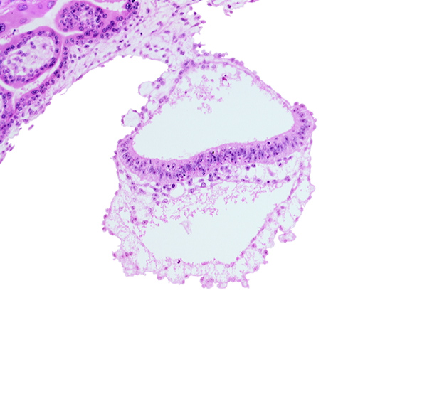 connecting stalk, epiblast, head mesenchyme, hypoblast, notochordal process, presumptive neural plate