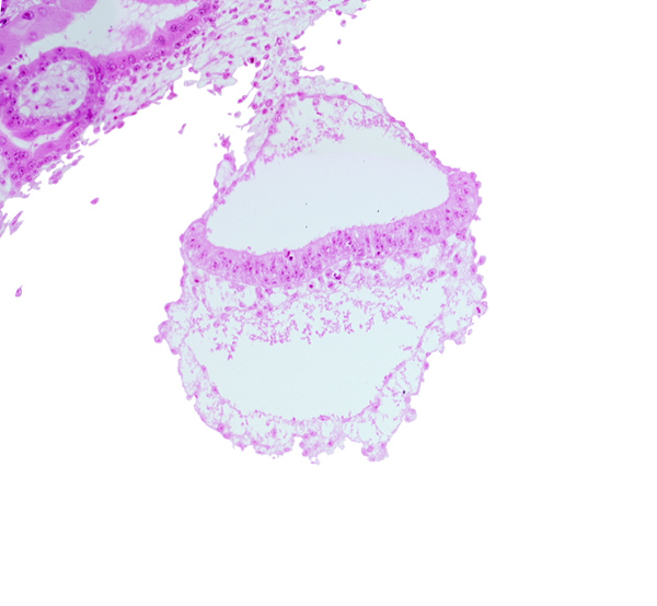 amniotic mesenchyme, epiblast, head mesenchyme, hemangiogenic tissue, hypoblast, notochordal process, presumptive neural plate, two-layered amnion, umbilical vesicle wall