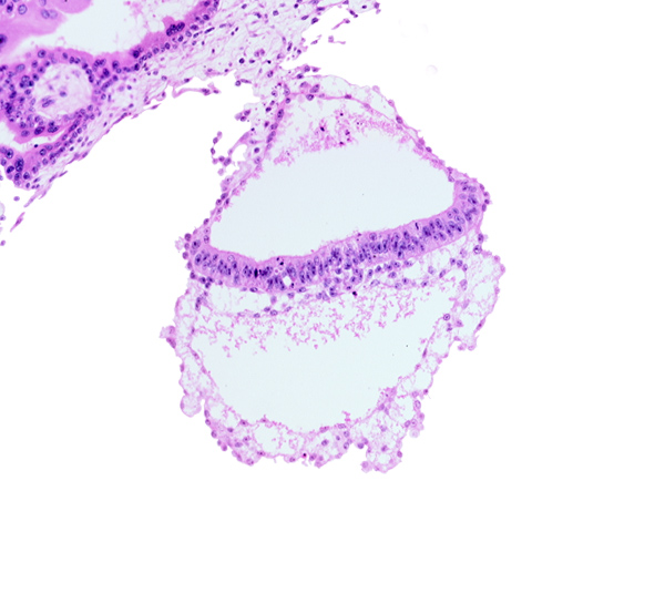 extra-embryonic ectoderm, gastrulation (primitive) node, head mesenchyme, hypoblast, one-layered epiblast