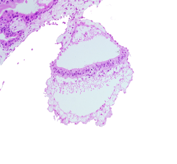 extra-embryonic ectoderm, gastrulation (primitive) node, head mesenchyme, hypoblast, one-layered epiblast