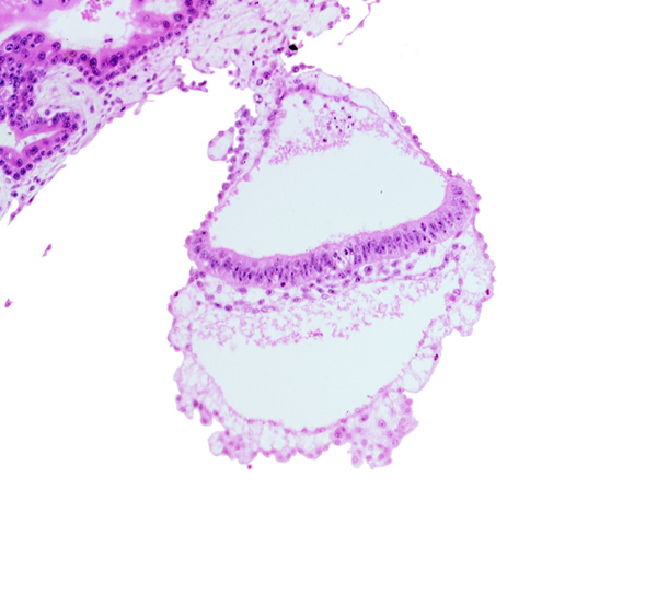 extra-embryonic ectoderm, head mesenchyme, hypoblast, one-layered epiblast