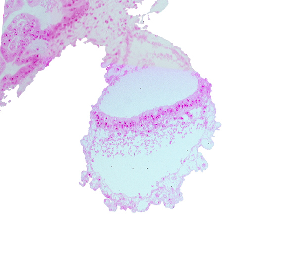 connecting stalk, gastrulation (primitive) node, head mesenchyme, lateral edge of embryonic disc, mesothelium