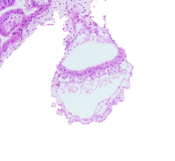 amnion, amniotic cavity, cephalic part of amniotic duct, embryonic endoderm, embryonic mesoderm, extra-embryonic mesoblast, gastrulation (primitive) streak, primordial blood vessel(s), umbilical vesicle cavity