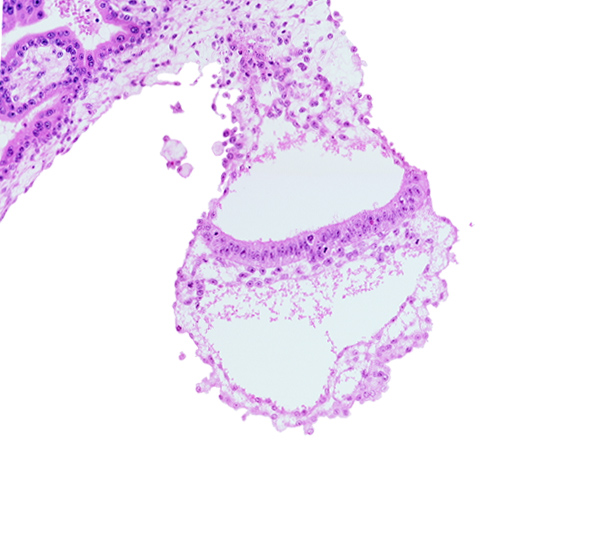 amnion, amniotic cavity, cephalic part of amniotic duct, embryonic endoderm, embryonic mesoderm, epiblast, extra-embryonic mesoblast, gastrulation (primitive) streak, primordial blood vessel(s), umbilical vesicle cavity