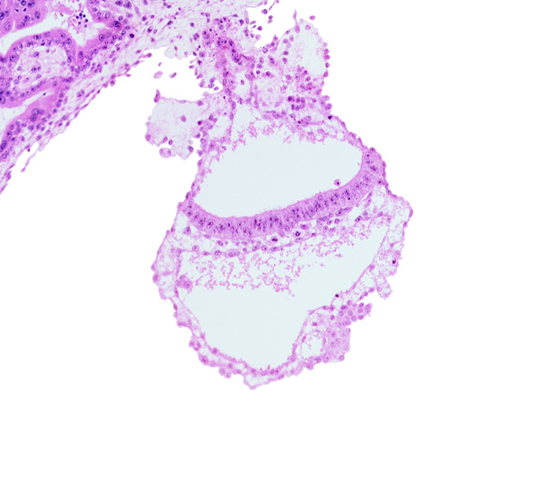 amnion, amniotic cavity, cephalic part of amniotic duct, embryonic endoderm, embryonic mesoderm, epiblast, gastrulation (primitive) streak, umbilical vesicle cavity