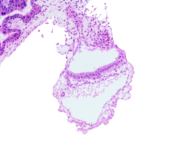 amniotic cavity, connecting stalk, cyst in umbilical vesicle wall, embryonic endoderm, embryonic mesoderm, gastrulation (primitive) streak, lateral edge of embryonic disc, presumptive angioblastic tissue, umbilical vesicle cavity