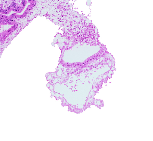 connecting stalk, embryonic endoderm, embryonic mesoderm, epiblast, extra-embryonic endoderm, gastrulation (primitive) groove, gastrulation (primitive) streak