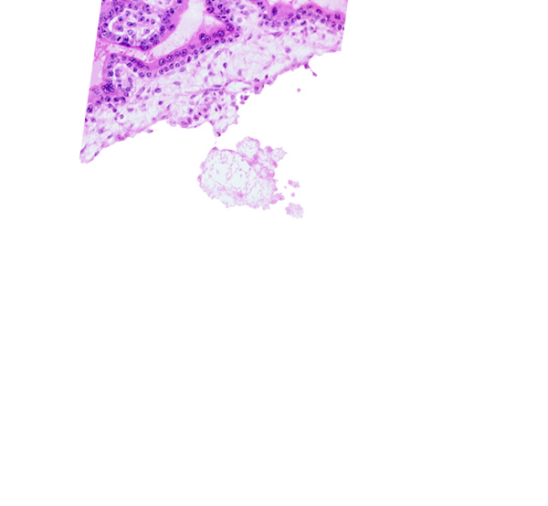 cephalic edge of connecting stalk, chorionic cavity, extra-embryonic mesoblast