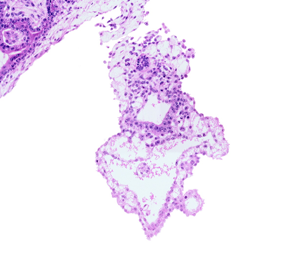 allantoic mesenchyme, amniotic cavity, caudal part of gastrulation (primitive) streak, distal end of allantoic diverticulum, embryonic endoderm, embryonic mesoderm, external cyst, internal cyst, primordial germ cell(s), umbilical vesicle wall