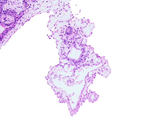 allantoic mesenchyme, amniotic cavity, caudal part of gastrulation (primitive) streak, distal part of allantoic diverticulum, external cyst, internal cyst, mesothelium, umbilical vesicle cavity, umbilical vesicle wall