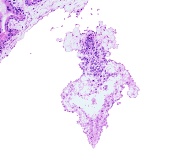 allantoic diverticulum (duct), allantoic mesenchyme, presumptive angioblastic tissue, primordial blood vessel(s)