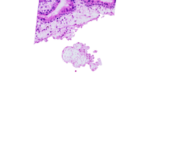 angioblastic tissue in secondary villus, chorionic plate, extra-embryonic mesoblast, intervillus space(s)