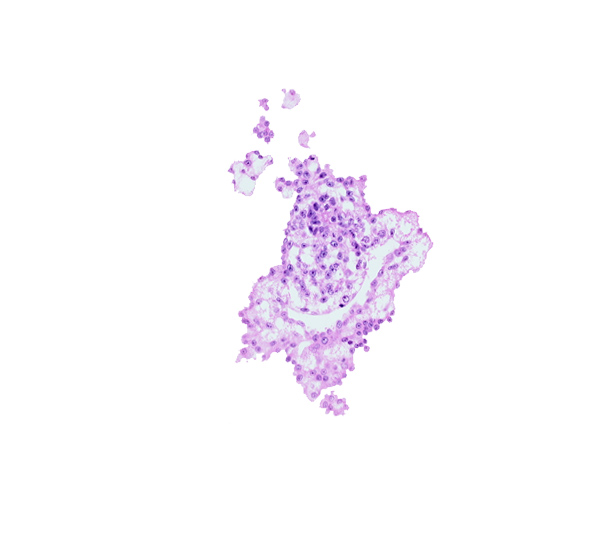 allantoic diverticulum (duct), allantoic mesenchyme, hemangiogenic tissue