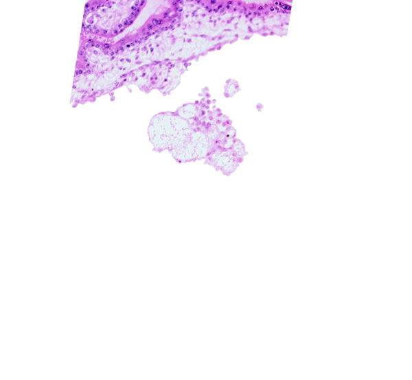 chorionic plate, extra-embryonic mesoblast, intervillus space(s)