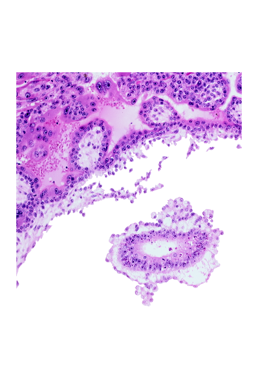 cephalic part of amniotic cavity, mesoblast (mesenchyme)