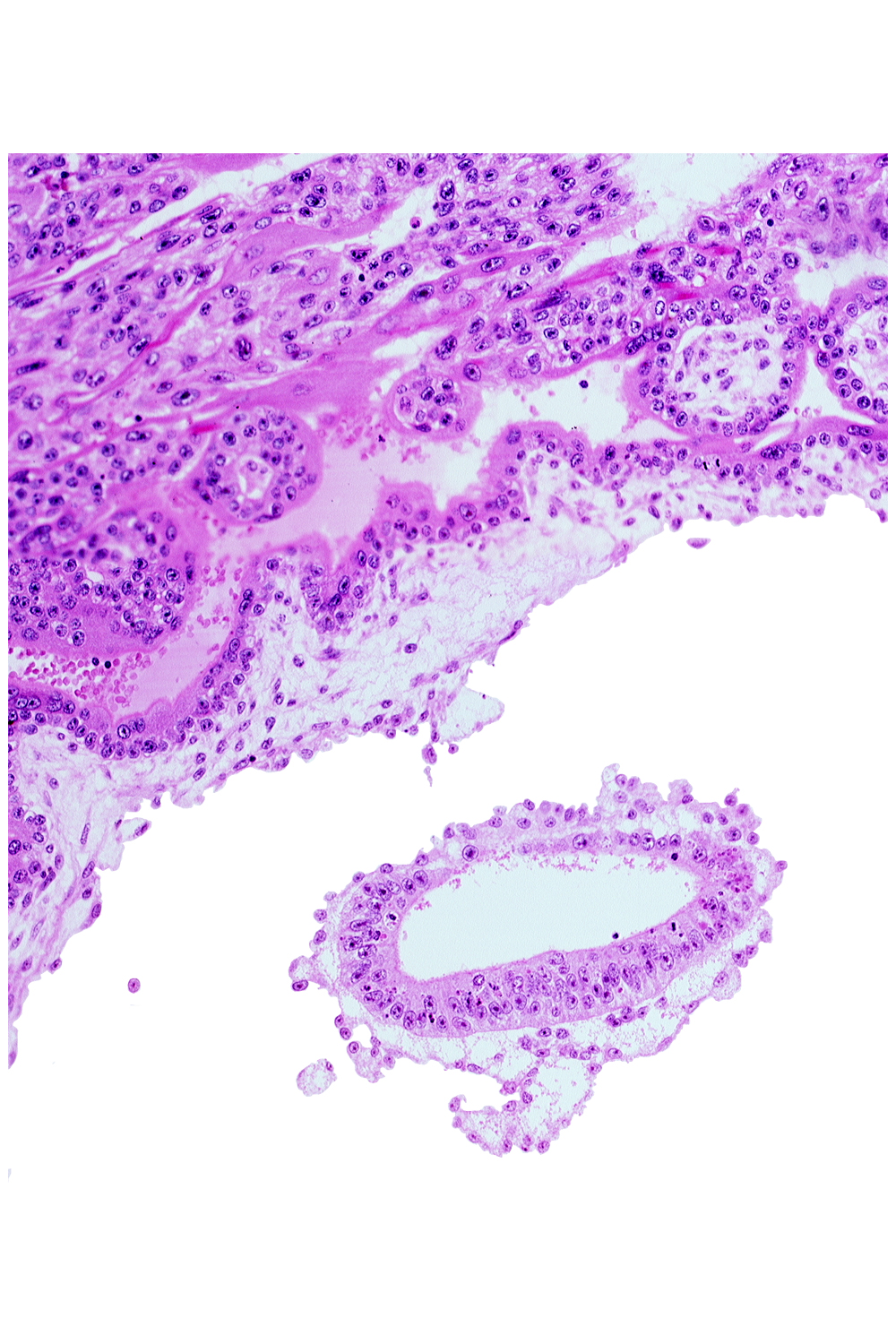 amniotic cavity, cephalic edge of amnion, epiblast, mesoblast