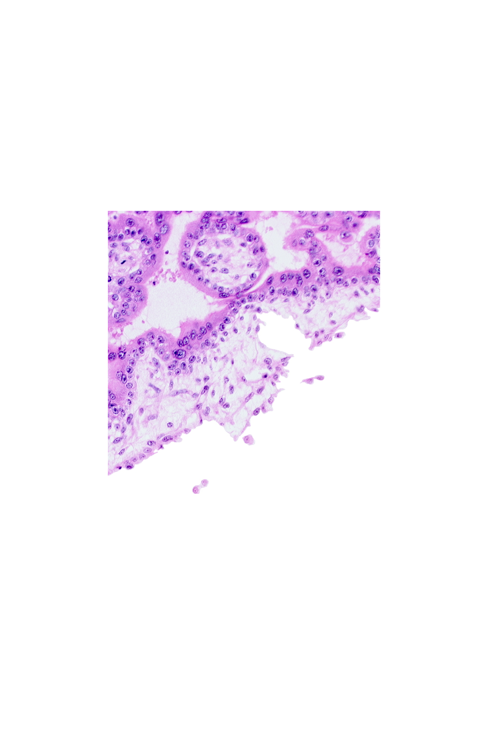 chorion, chorionic cavity (extra-embryonic coelom or exocoelom), cytotrophoblast, floating villus, intervillus space(s), syncytiotrophoblast