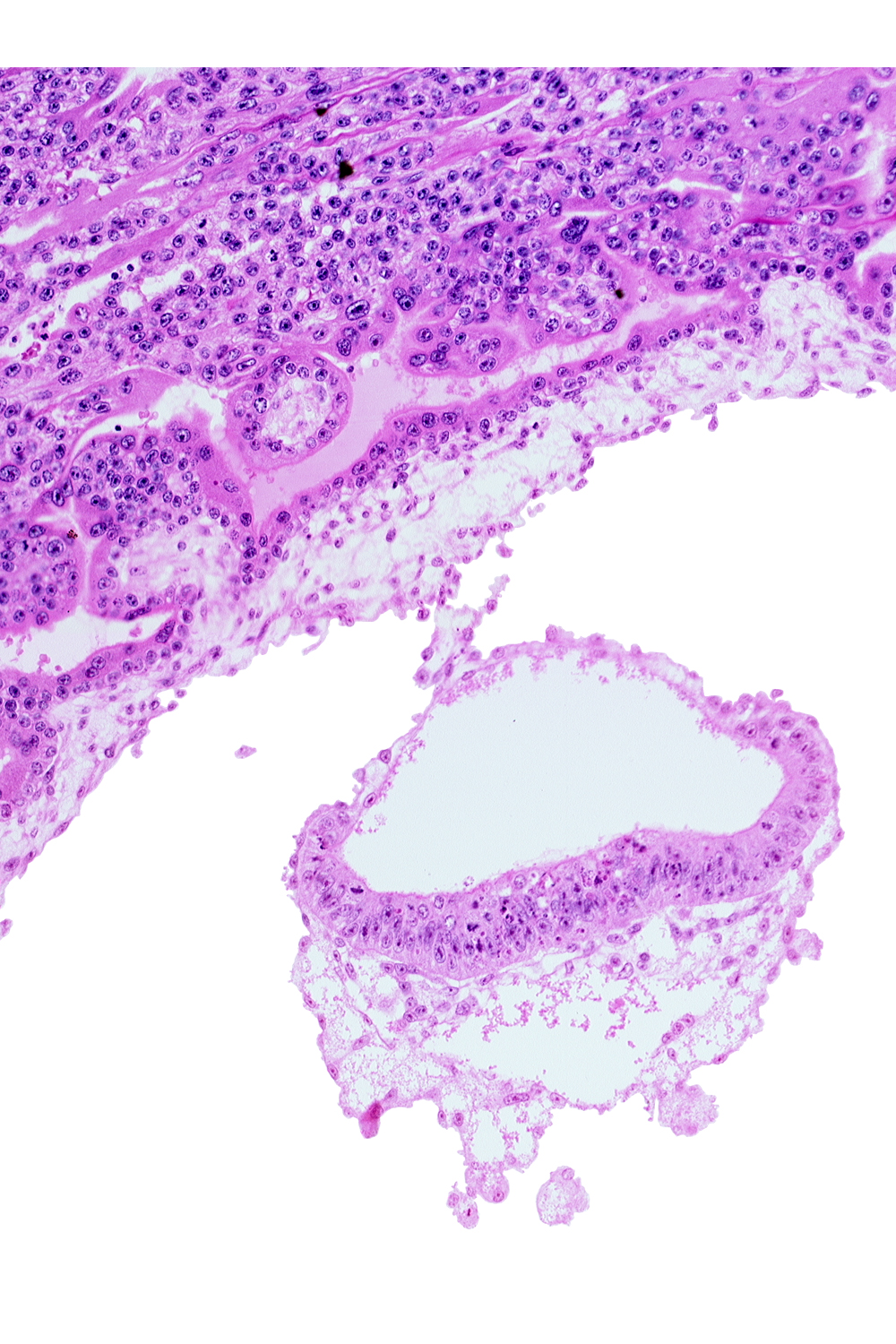 amnion, amniotic cavity, connecting stalk, epiblast, extra-embryonic endoderm, extra-embryonic mesoblast, head mesenchyme, hypoblast, umbilical vesicle cavity