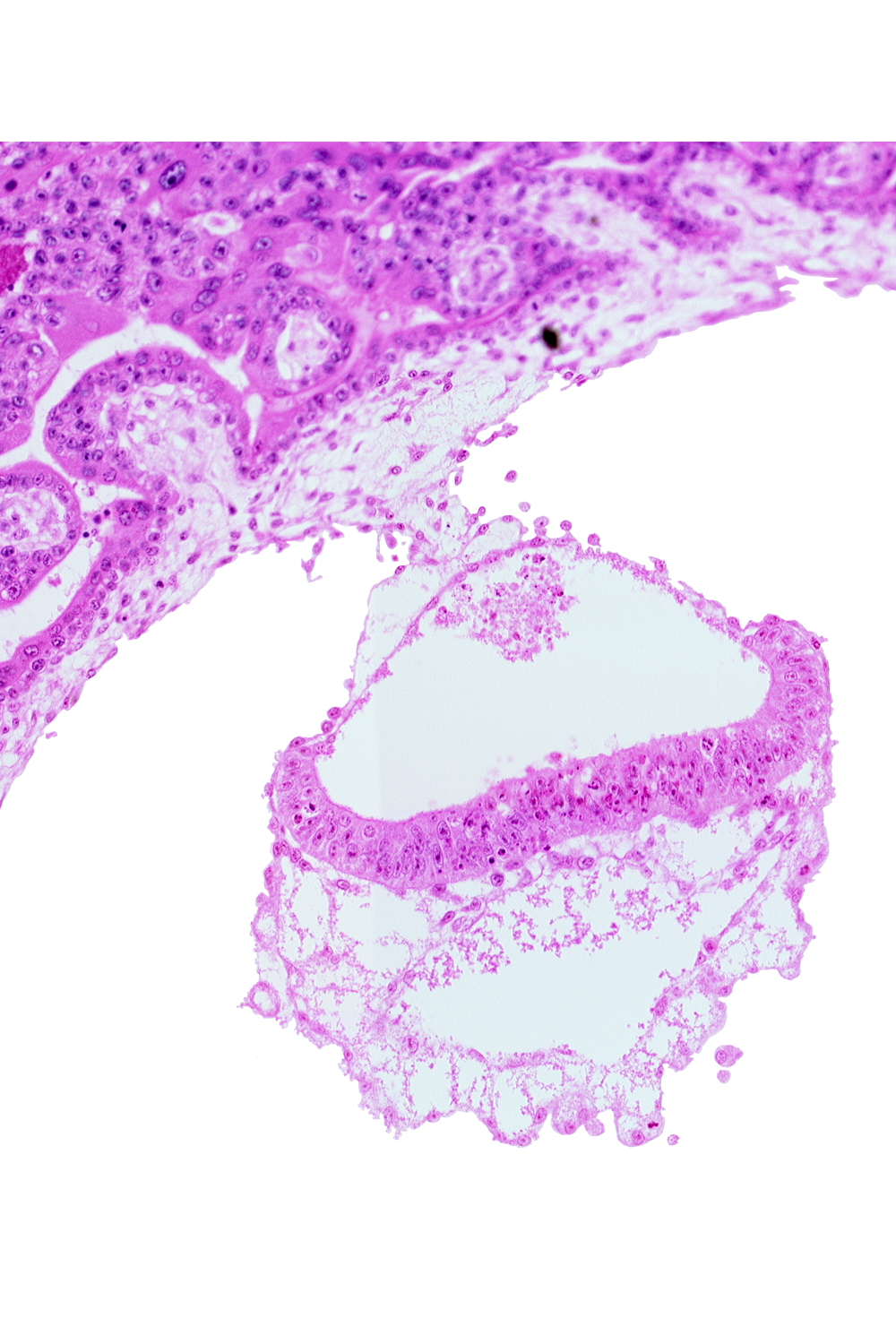 connecting stalk, extra-embryonic coelom, junction of amnion and epiblast plate, primordial blood vessel(s), two-layered amnion, umbilical vesicle wall