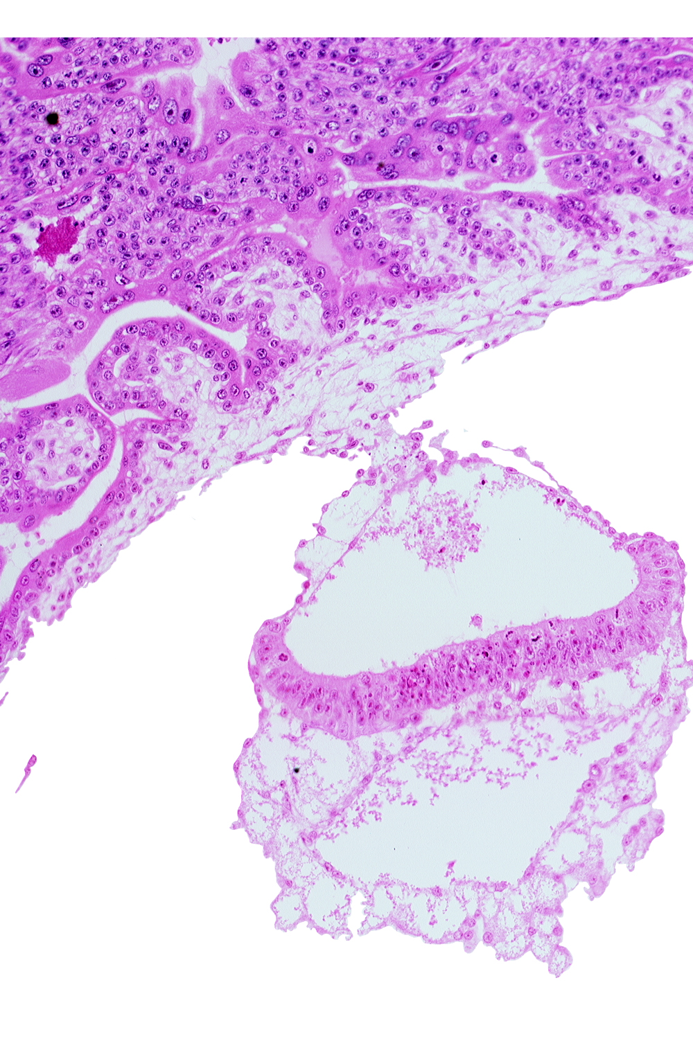 amniotic cavity, cephalic end of notochordal process, epiblast, extra-embryonic endoderm, hemangiogenic tissue, hypoblast, mesothelium of umbilical vesicle, presumptive neural plate, two-layered amnion, umbilical vesicle cavity
