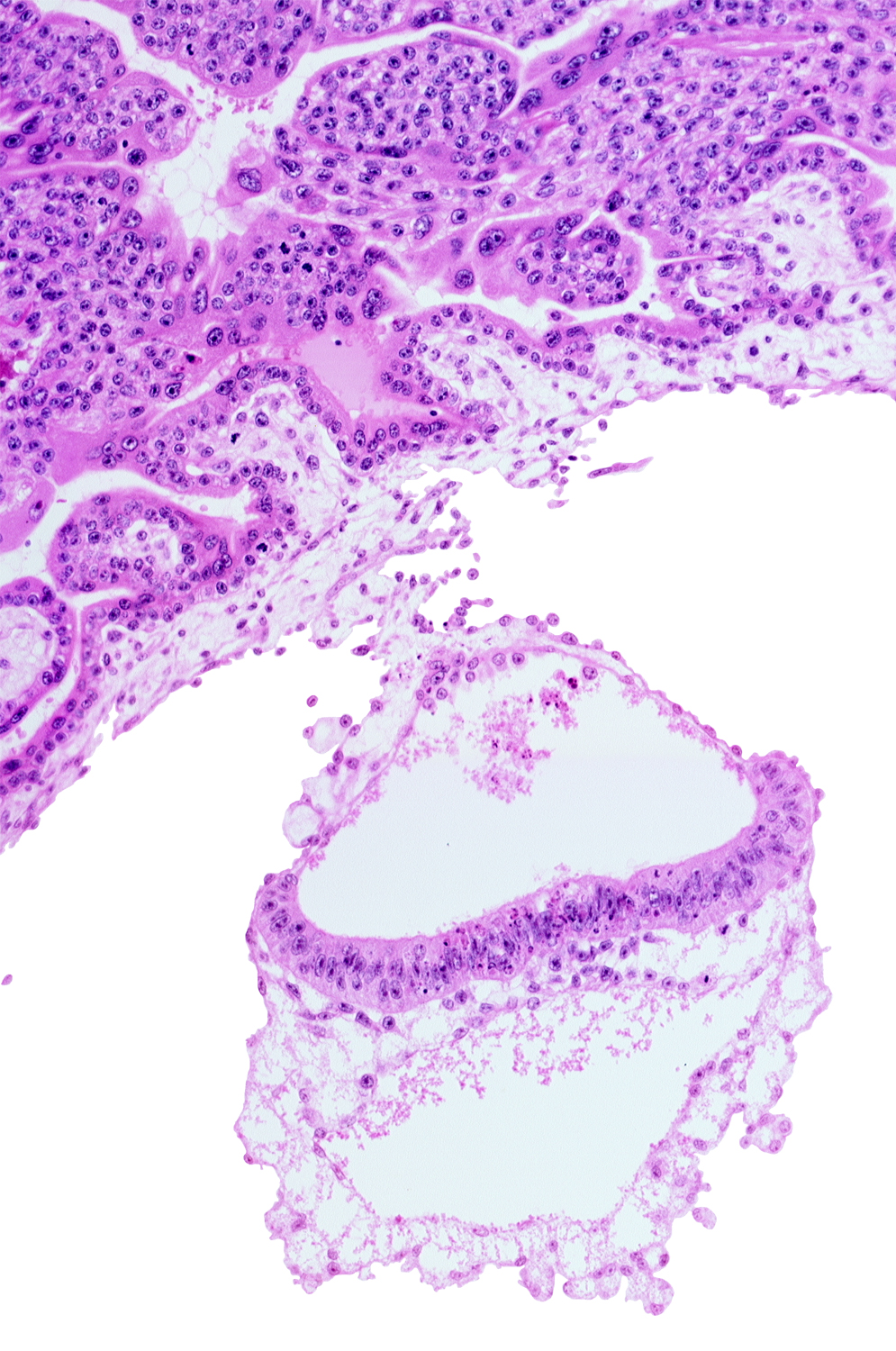 connecting stalk, epiblast, head mesenchyme, hypoblast, mesoblast, notochordal process, presumptive neural plate