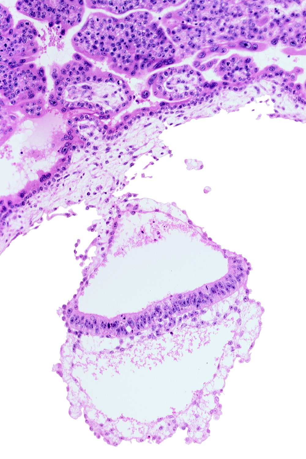 extra-embryonic ectoderm, gastrulation (primitive) node, head mesenchyme, hypoblast, one-layered epiblast