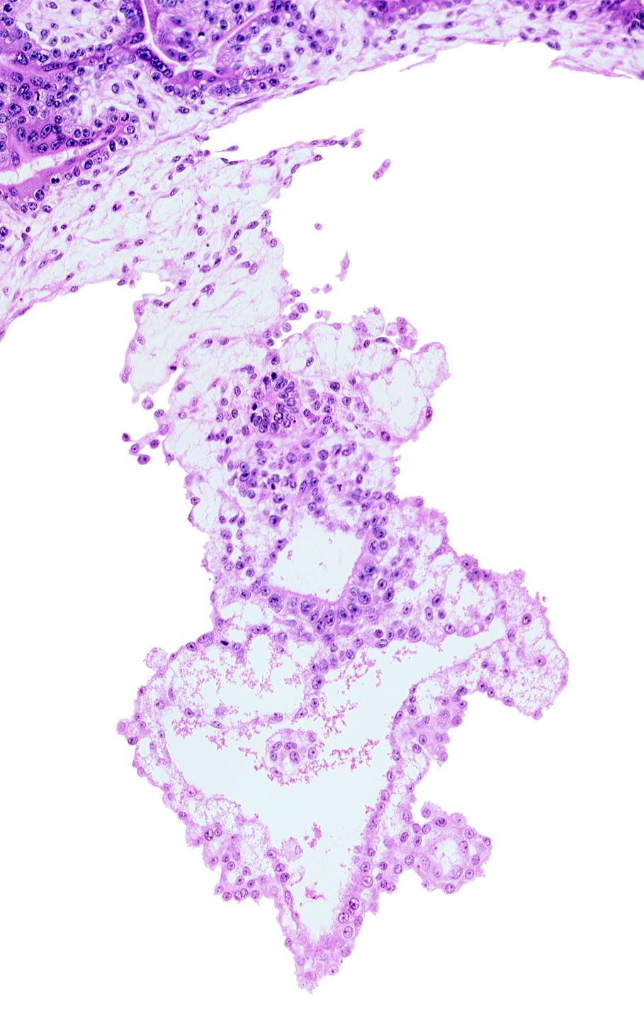 allantoic mesenchyme, amniotic cavity, caudal part of gastrulation (primitive) streak, distal part of allantoic diverticulum, external cyst, internal cyst, mesothelium, umbilical vesicle cavity, umbilical vesicle wall