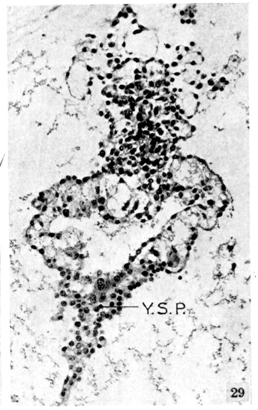 Umbilical vesicle process