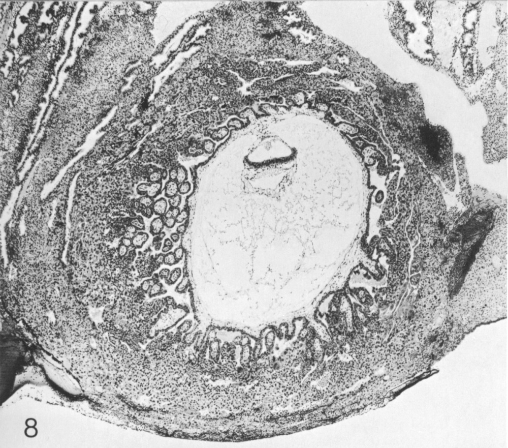 The chorionic vesicle