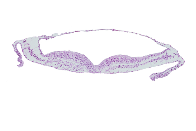 head mesenchyme, neural ectoderm, presumptive neural crest, umbilical vesicle wall