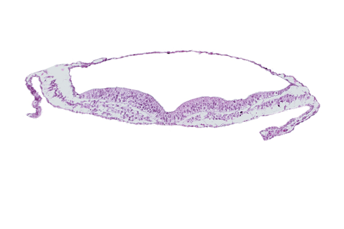 amnion, amniotic cavity, extra-embryonic endoderm