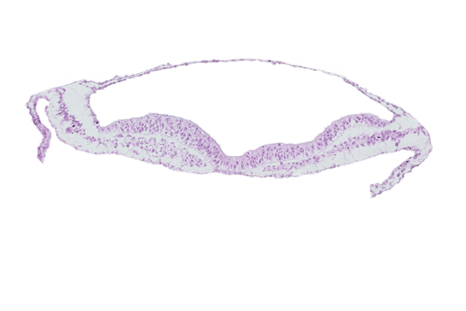 amnion, extra-embryonic endoderm, extra-embryonic mesoderm, head mesenchyme, neural groove, notochordal plate