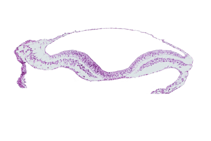 amnion, blood vessel(s), extra-embryonic endoderm, extra-embryonic mesoderm, head mesenchyme, neural fold, neural groove, notochordal plate, ventral groove (artifact?)