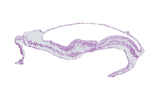 lateral plate mesoderm, notochordal (primitive) pit, notochordal process, transverse groove