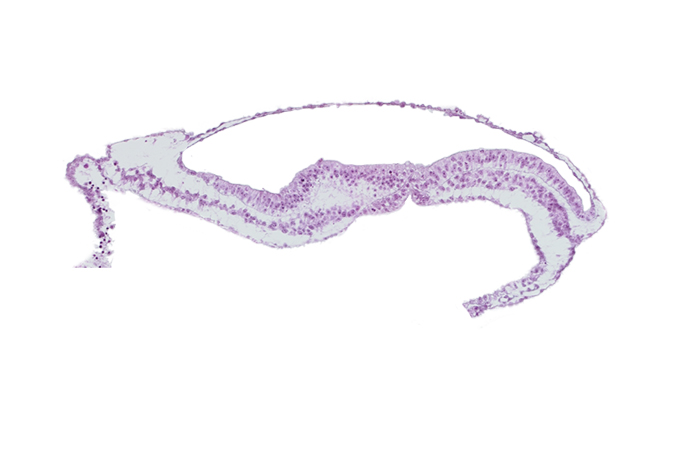 amniotic cavity, endoderm, epiblast, mesoderm, neurenteric canal, transverse groove, umbilical vesicle cavity