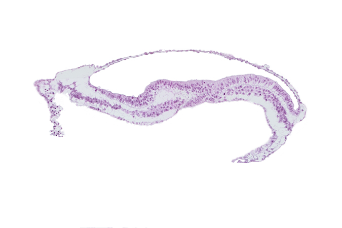 amnion, notochordal process, transverse groove, umbilical vesicle wall