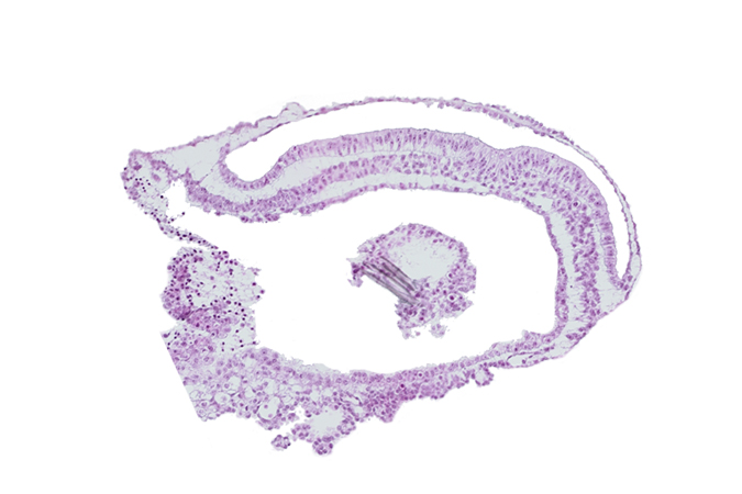 amniotic cavity, connecting stalk, extra-embryonic coelom, lateral plate mesoderm, umbilical vesicle cavity