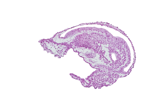 allantoic diverticulum, amnion, amniotic cavity, caudal edge of umbilical vesicle cavity