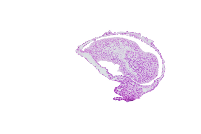 allantoic diverticulum in connecting stalk, amniotic cavity, epiblast, gastrulation (primitive) groove, mesoderm, tail fold region, tangentially cut epiblast