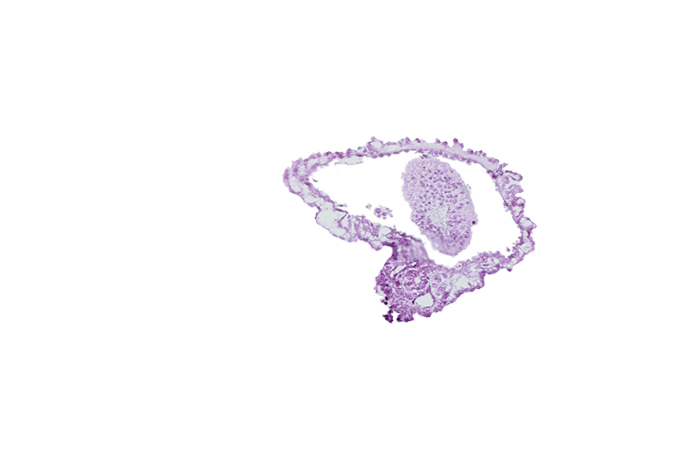 allantoic diverticulum in connecting stalk, amnion, amniotic cavity, epiblast of caudal eminence