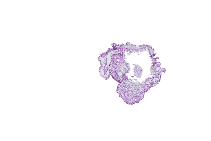 allantoic diverticulum in connecting stalk, amnion, amniotic cavity, caudal edge of caudal eminence, extra-embryonic coelom