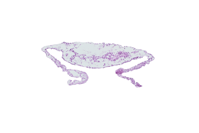 blood vessel(s), cardiac mesoderm, extra-embryonic mesoderm, umbilical vesicle cavity