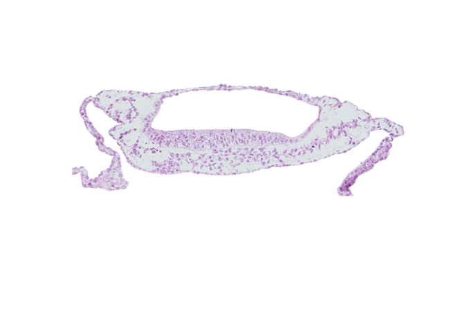 cephalic end of prechordal plate, isolated coelomic space