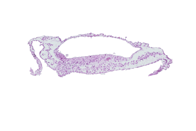 neural groove, prechordal plate