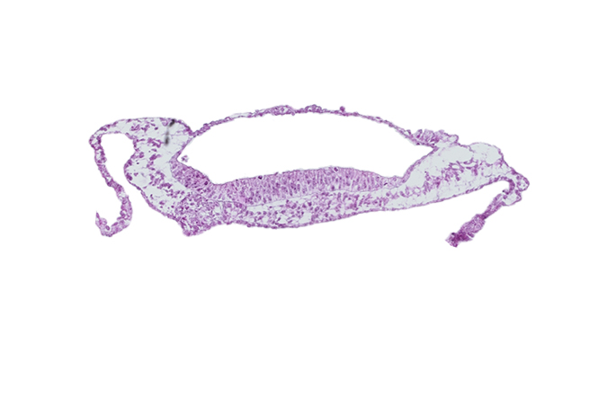 embryonic endoderm, head mesenchyme, isolated coelomic space, neural groove, neural plate, prechordal plate